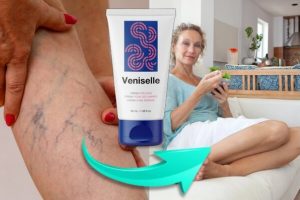 Veniselle: crema para venas varicosas y el alivio rápido del dolor y las piernas? Comentarios